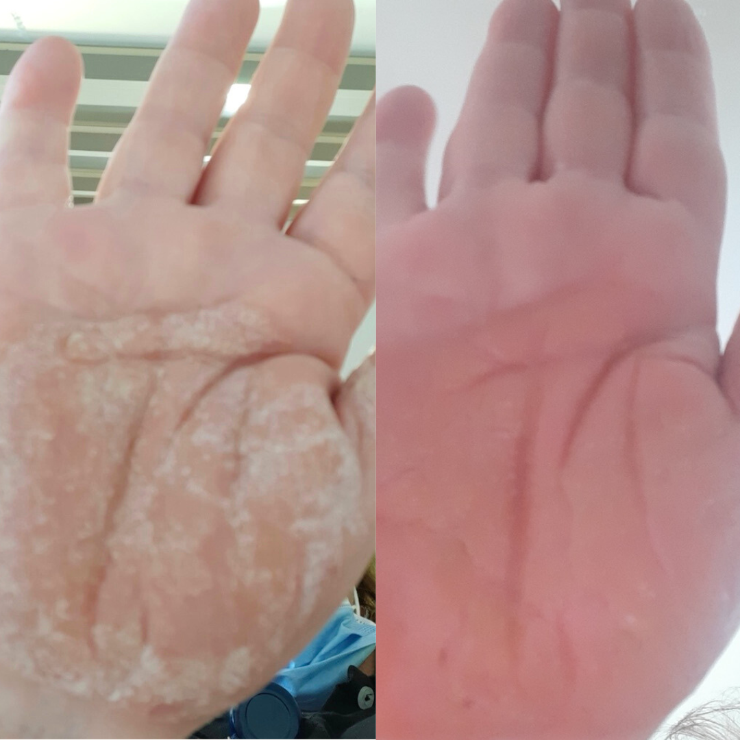 Double the Mirekal Oil 50ml