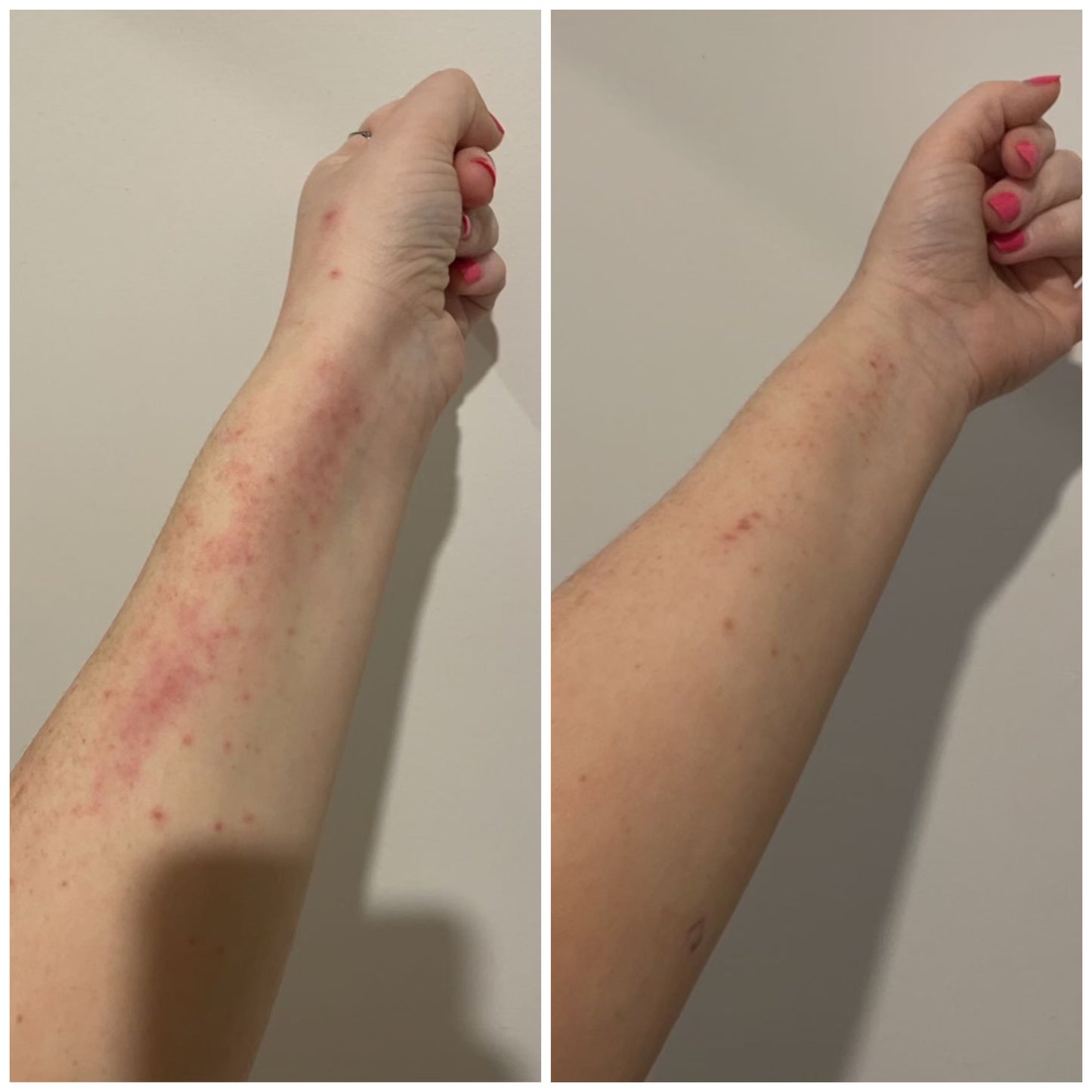 Double the Mirekal Oil 50ml