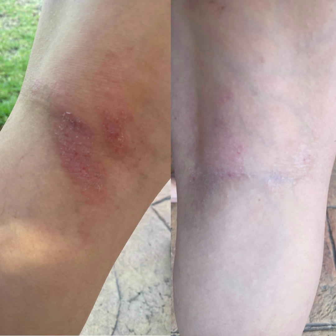 Double the Mirekal Oil 50ml